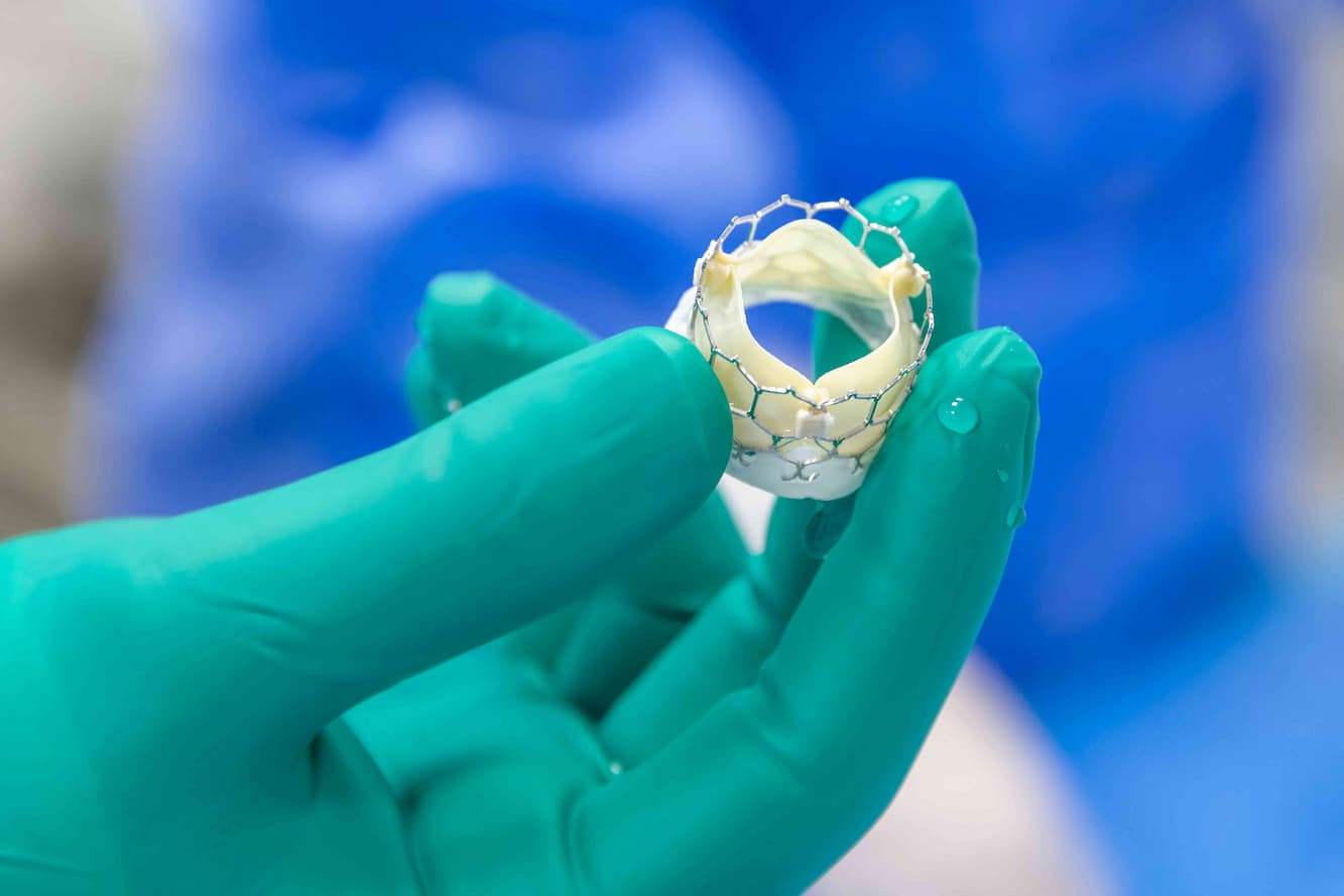 Aortic Valve Replacement