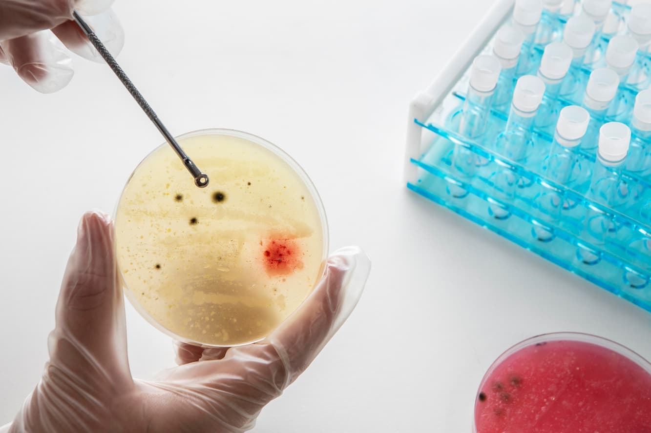 IVF with Fresh Transfer - Medvoyage