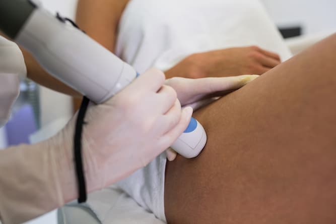woman receiving laser epilation treatment her thigh