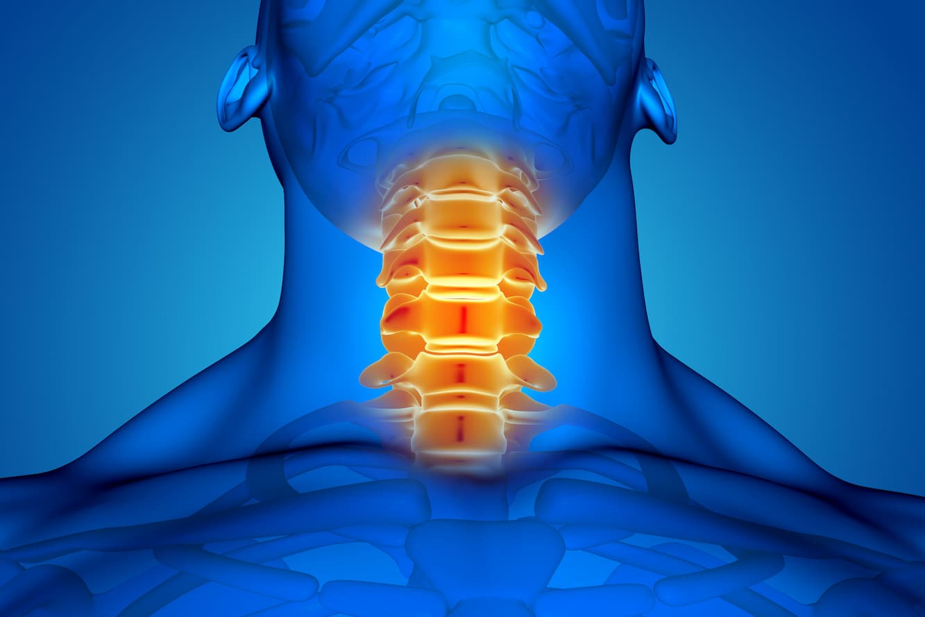 Cervical Decompression Surgery