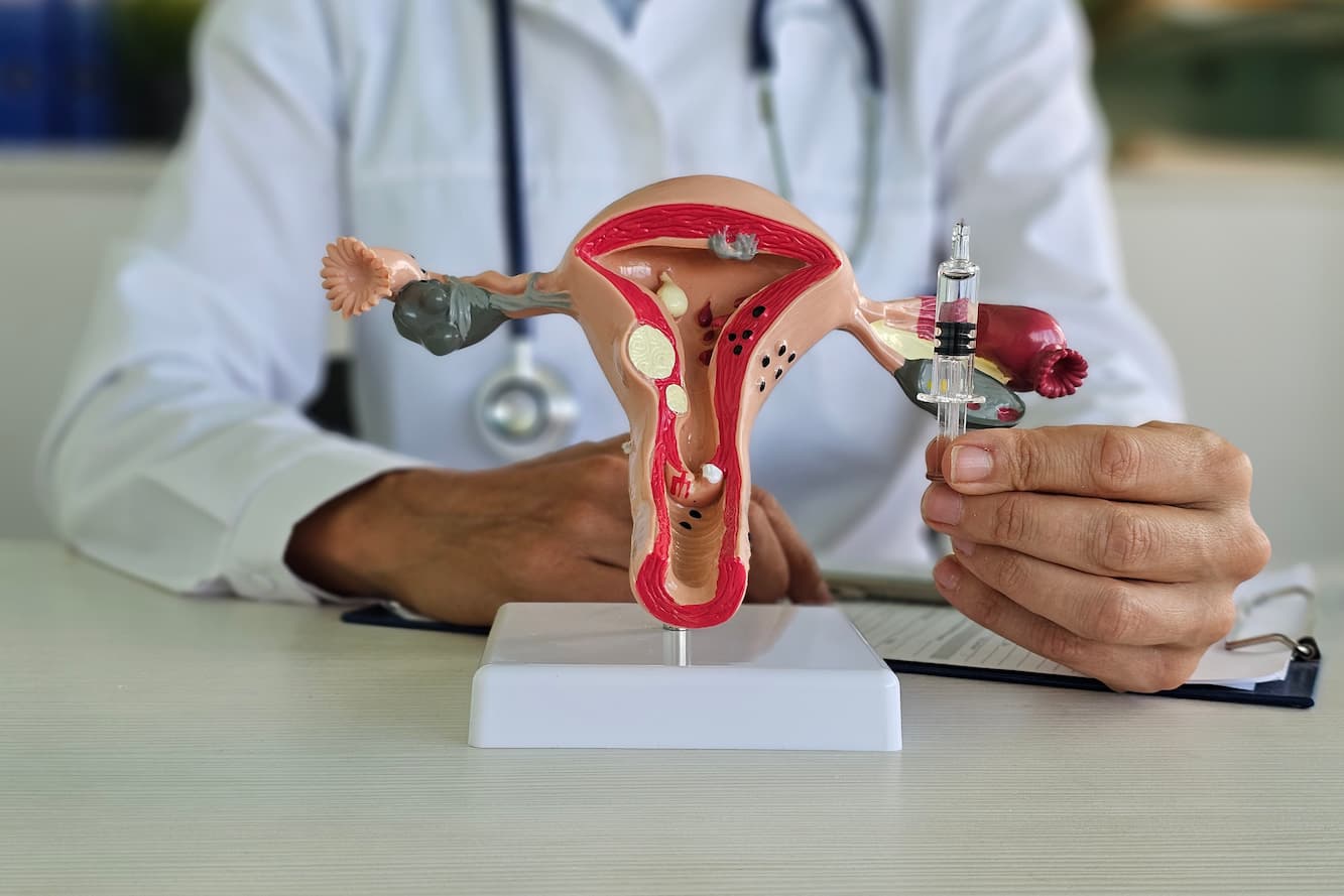 IVF with Frozen Transfer